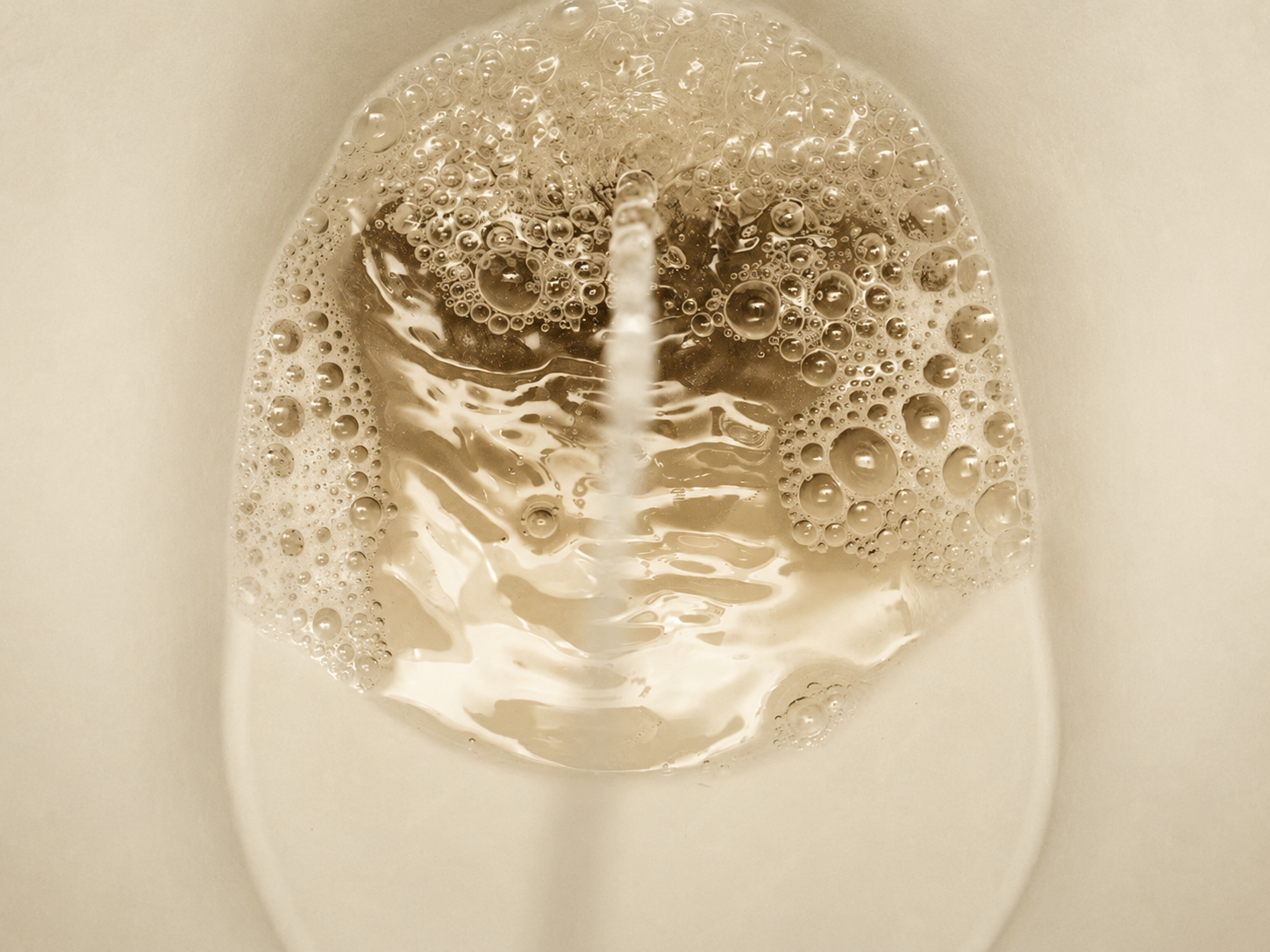 Espuma no xixi